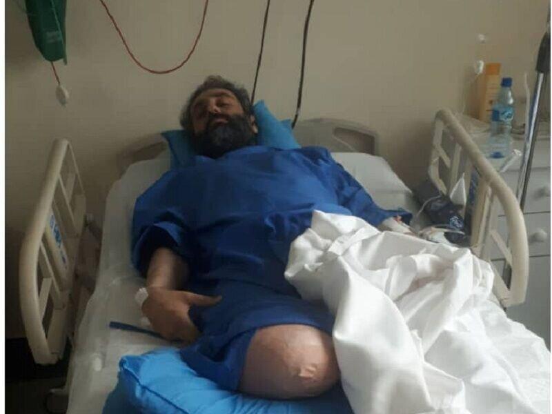 محیط بان قطع عضو شده خوزستانی تحت حمایت قرار می گیرد محیط بان قطع عضو شده خوزستانی تحت حمایت قرار می گیرد