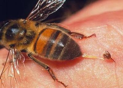 درمان دردناک بیماران با نیش زنبور عسل!